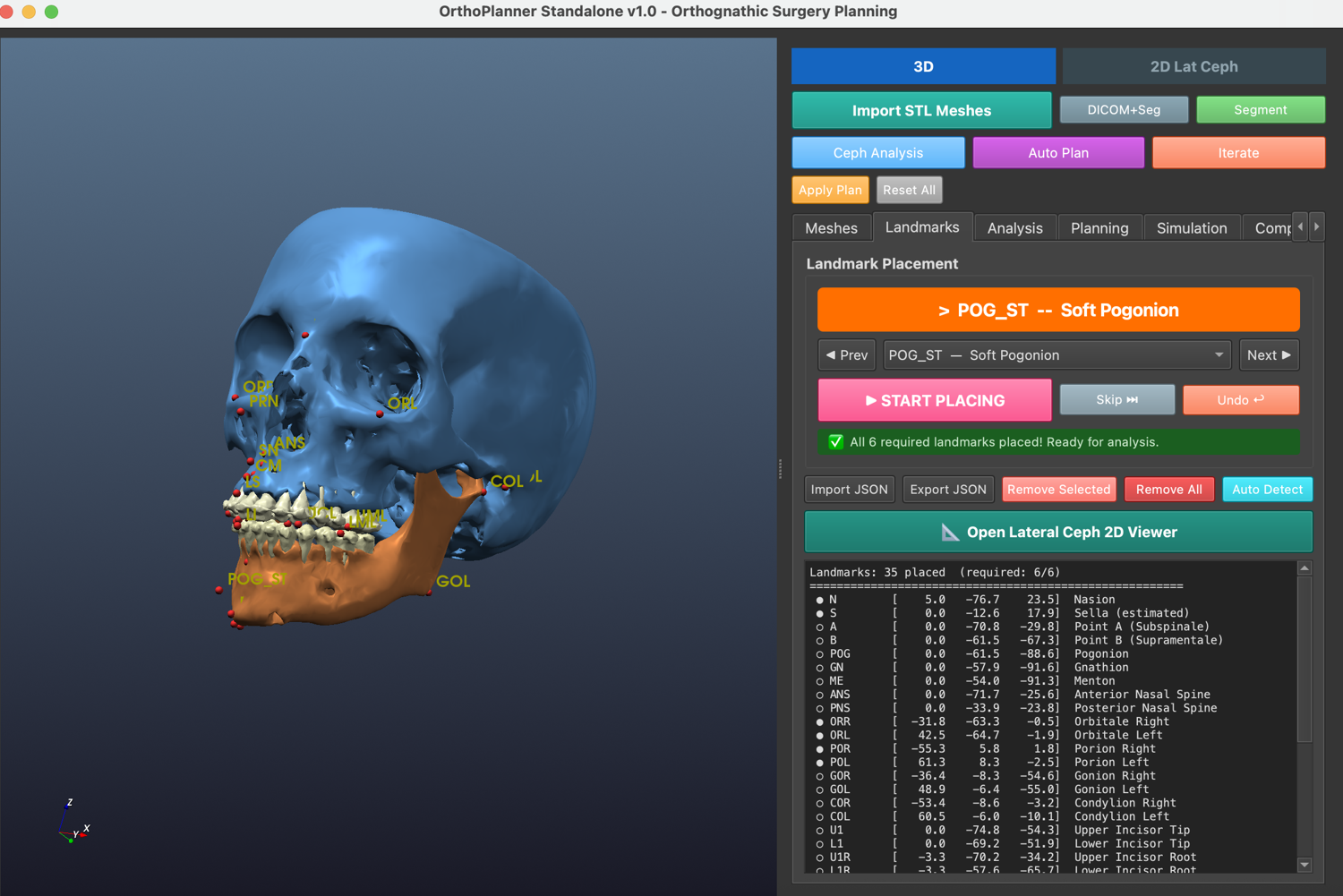 OrthoPlanner — yapay zekâ destekli 3D ortognatik cerrahi planlama yazılımı